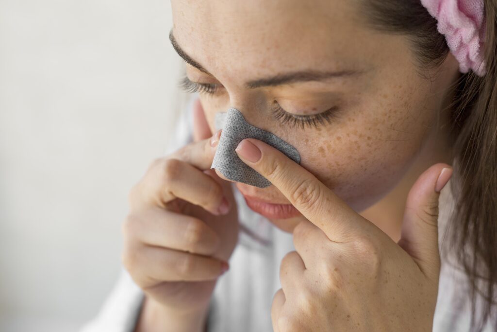 How to get rid of blackheads